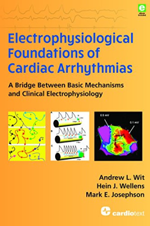 electrophysiological foundations of cardiac arrhythmias: a bridge between basic mechanisms and clinical electrophysiology