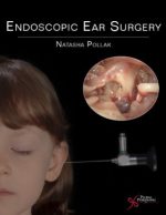 endoscopic ear surgery