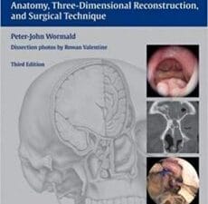 Endoscopic Sinus Surgery: Anatomy, Three-Dimensional Reconstruction, and Surgical Technique Edition 3