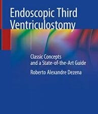 endoscopic third ventriculostomy: classic concepts and a state of the art guide
