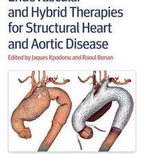 Endovascular and Hybrid Therapies for Structural Heart and Aortic Disease