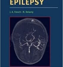 epilepsy (therapeutic strategies)