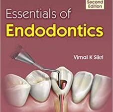 Essentials of Endodontics 2nd Edition