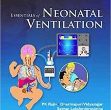 Essentials of Neonatal Ventilation, 1st edition