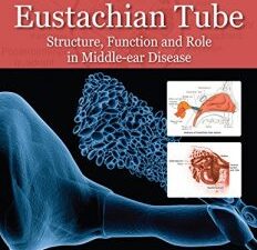 eustachian tube: structure, function, and role in middle ear disease, 2e