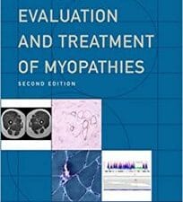 evaluation and treatment of myopathies
