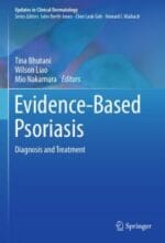 evidence based psoriasis: diagnosis and treatment