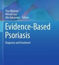 evidence based psoriasis: diagnosis and treatment