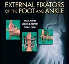 external fixators of the foot and ankle 1st edition