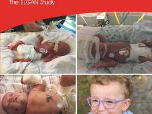 extremely preterm birth and its consequences: the elgan study (clinics in developmental medicine)