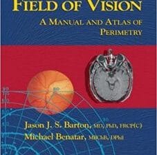 Field of Vision: A Manual and Atlas of Perimetry