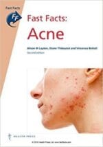 Fast Facts: Acne 2nd Edition