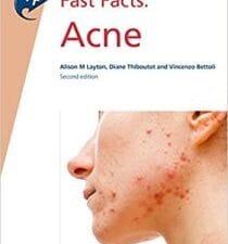 Fast Facts: Acne 2nd Edition