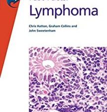 fast facts: lymphoma