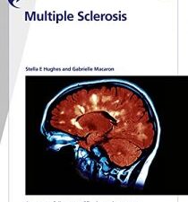 fast facts: multiple sclerosis: a new era of disease modification and treatment