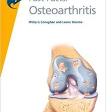 fast facts: osteoarthritis 1st edition