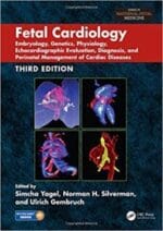 Fetal Cardiology: Embryology, Genetics, Physiology, Echocardiographic Evaluation, Diagnosis, and Perinatal Management