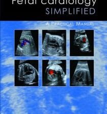 Fetal Cardiology Simplified: A Practical Manual