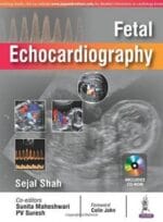Fetal Echocardiography