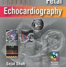 Fetal Echocardiography