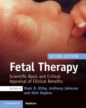 fetal therapy: scientific basis and critical appraisal of clinical benefits 2nd edition