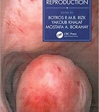 fibroids and reproduction