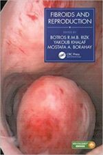 fibroids and reproduction 1st edition