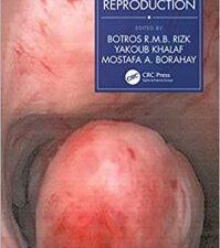fibroids and reproduction 1st edition