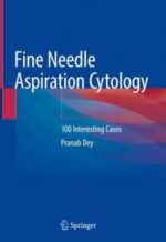 fine needle aspiration cytology: 100 interesting cases