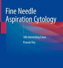 fine needle aspiration cytology: 100 interesting cases