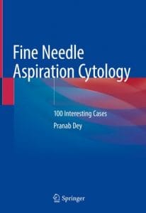 fine needle aspiration cytology: 100 interesting cases