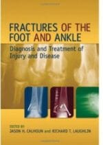 fractures of the foot and ankle: diagnosis and treatment of injury and disease