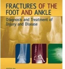 fractures of the foot and ankle: diagnosis and treatment of injury and disease