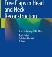 free flaps in head and neck reconstruction: a step by step color atlas