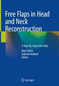 free flaps in head and neck reconstruction: a step by step color atlas