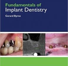 Fundamentals of Implant Dentistry