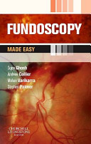 fundoscopy made easy 1st edition