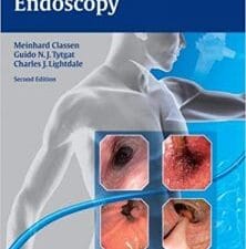 gastroenterological endoscopy 2nd edition