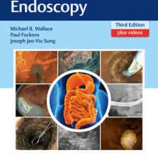 gastroenterological endoscopy, third edition
