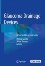 glaucoma drainage devices: a practical illustrated guide