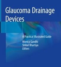 glaucoma drainage devices: a practical illustrated guide