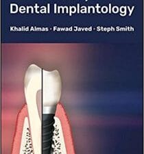 Glossary of Dental Implantology
