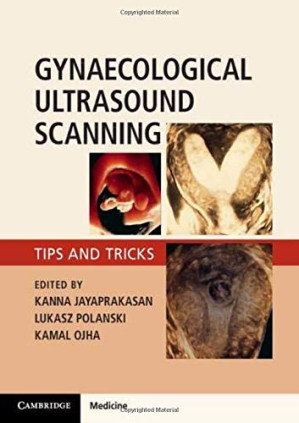 gynaecological ultrasound scanning: tips and tricks 1st edition