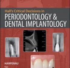 Hall’s Critical Decisions in Periodontology