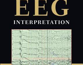 handbook of eeg interpretation 2nd edition