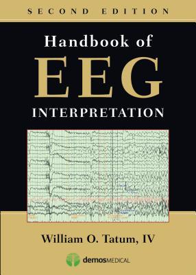 handbook of eeg interpretation 2nd edition