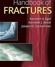handbook of fractures 5th edition