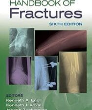 handbook of fractures, sixth edition
