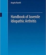 handbook of juvenile idiopathic arthritis