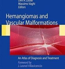 hemangiomas and vascular malformations: an atlas of diagnosis and treatment